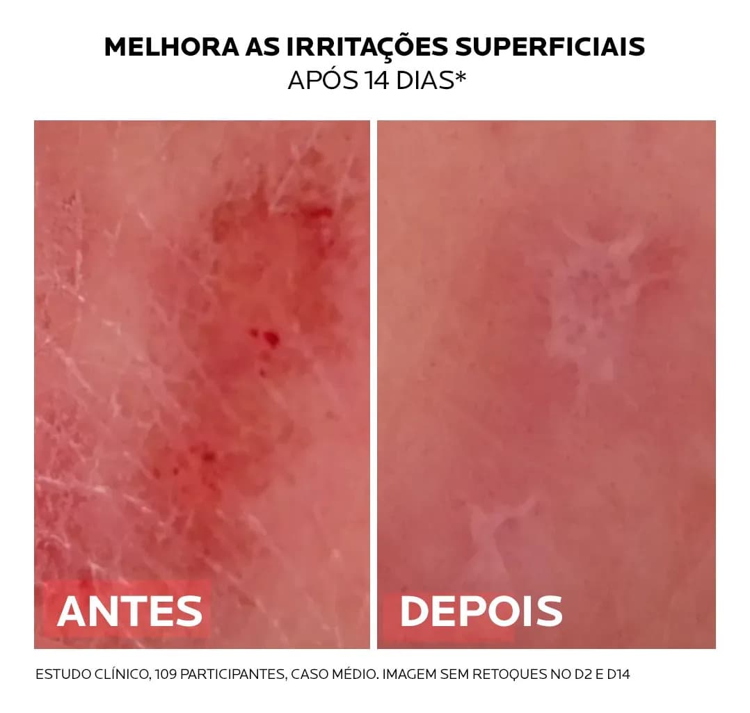 Creme Multirreparador Pele Sensível Cicaplast Baume B5+ La Roche-Posay 20ml — imagem 6