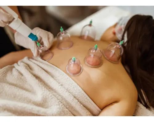 Kit Ventosas Com Bomba Ventosa Terapia Massoterapia Massagem — imagem 3