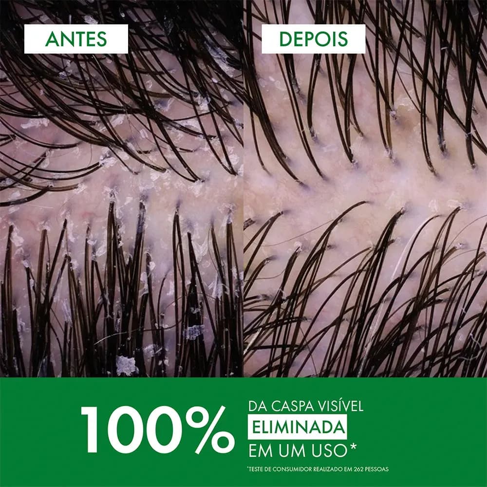 Shampoo Anticaspa Cabelos Normais a Oleosos, Dercos DS Vichy, 300g — imagem 4